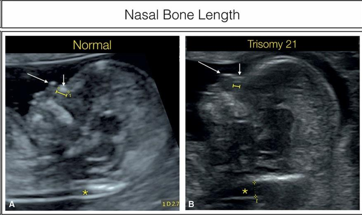MRI Image Preview