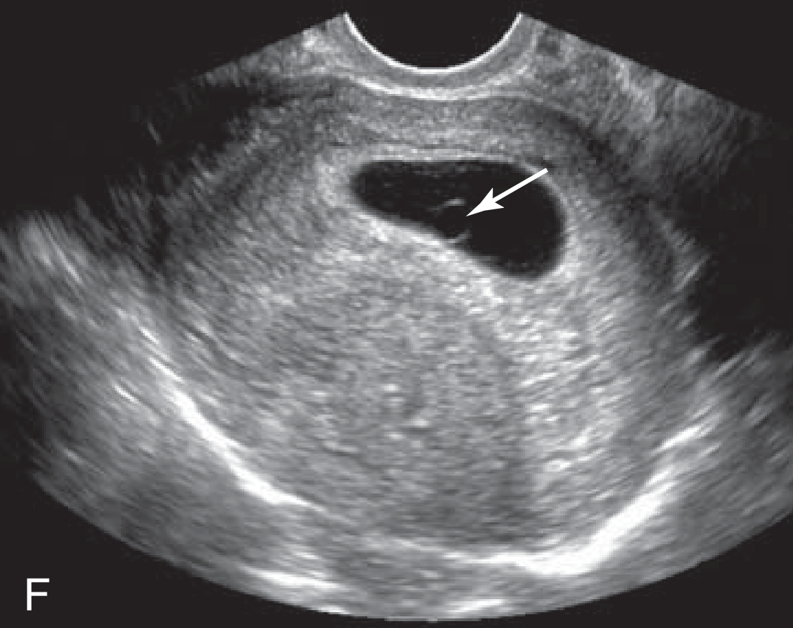 MRI Image Preview