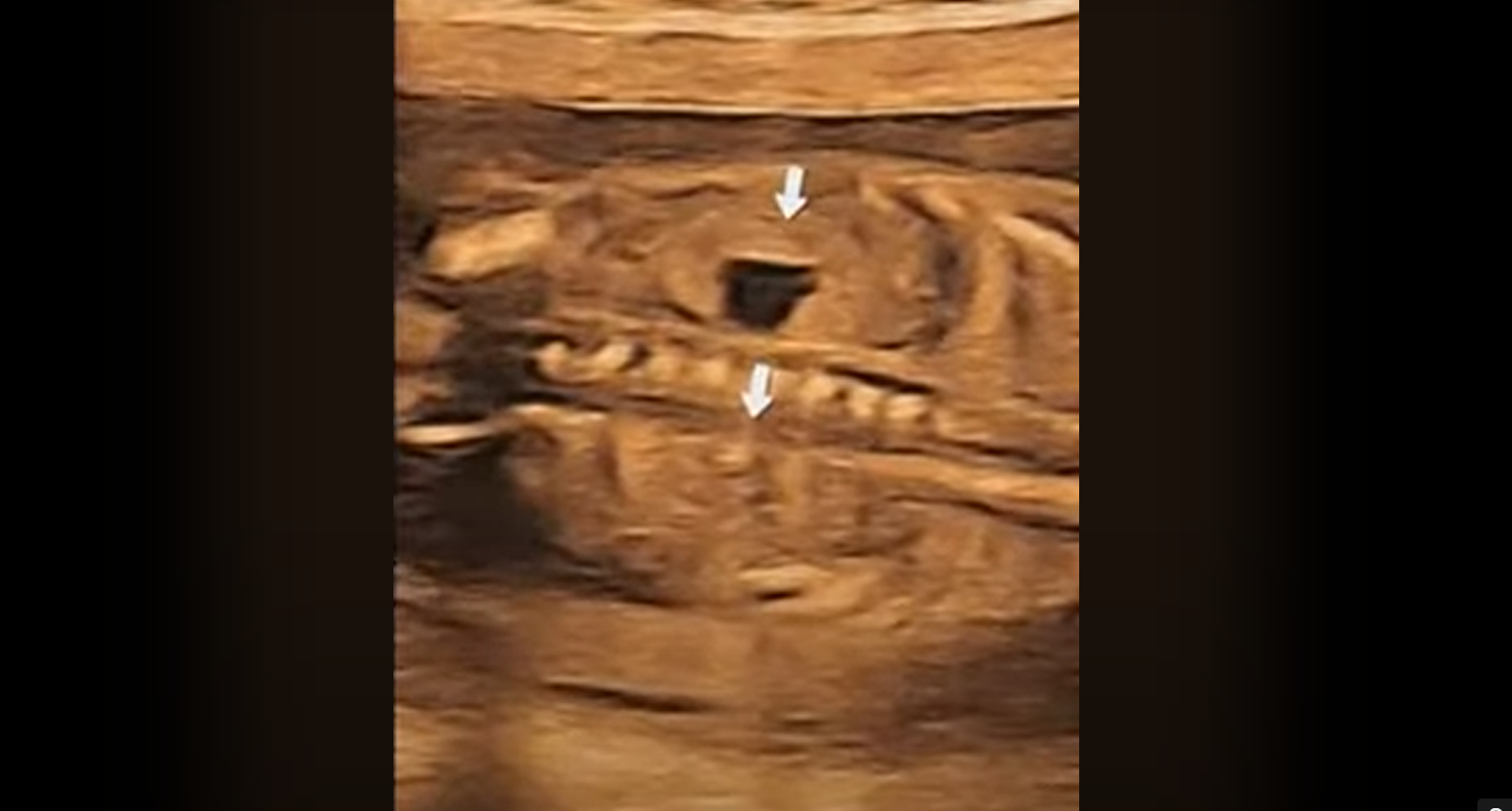 MRI Image Preview