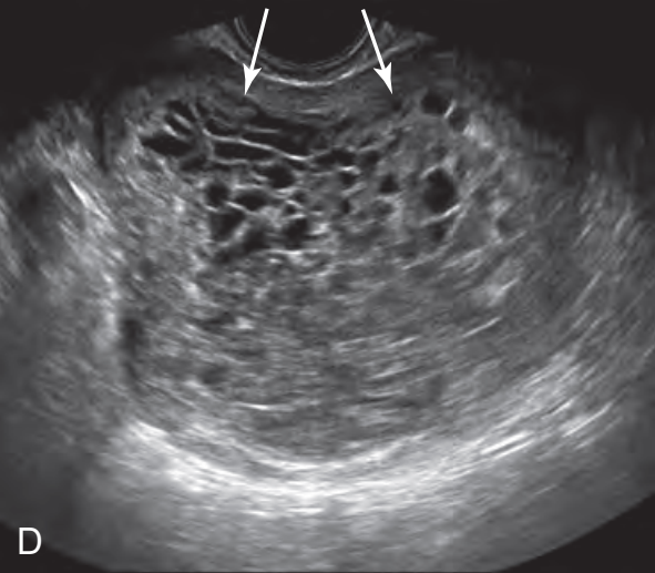 MRI Image Preview