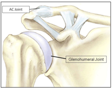 Tiêu đầu xa xương đòn (Distal clavicle osteolysis)