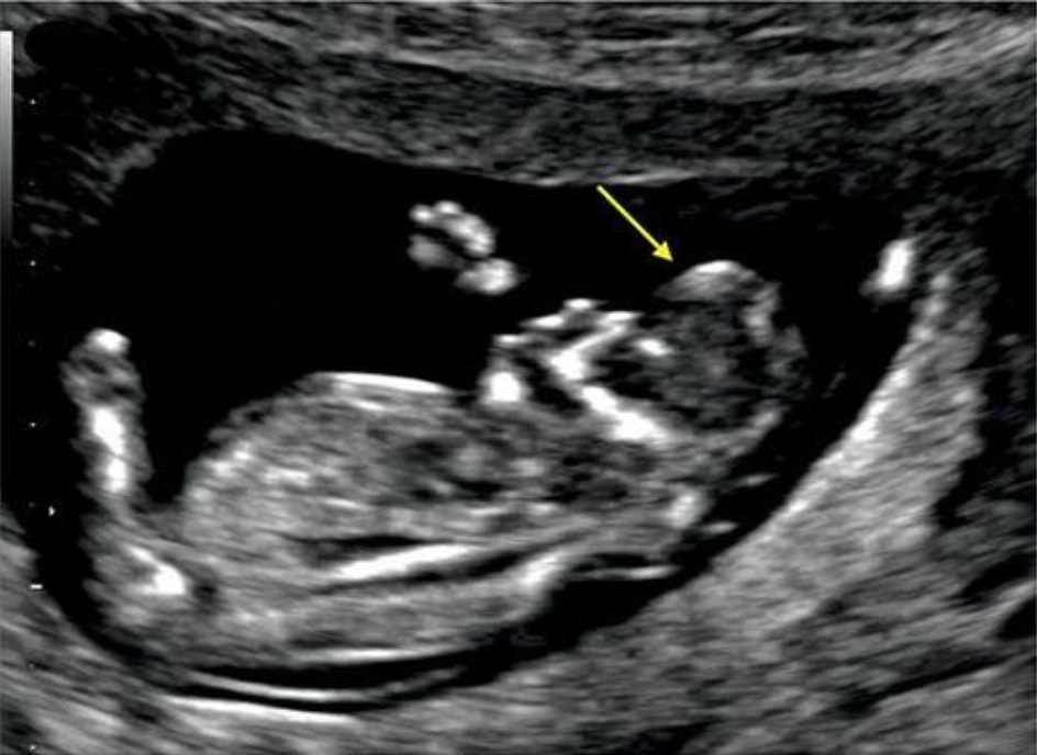 MRI Image Preview
