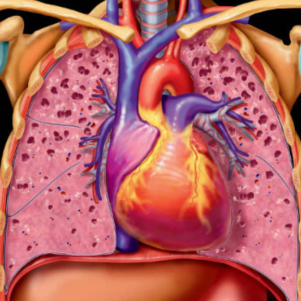 Bệnh mô bào Langerhans ở phổi (Pulmonary Langerhans Cell Histiocytosis - PLCH)