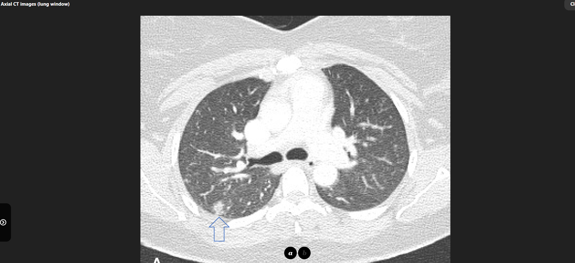 MRI Image Preview
