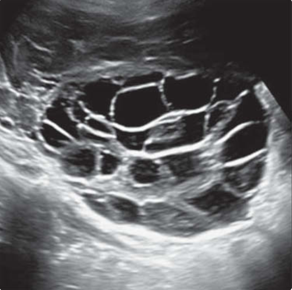 MRI Image Preview