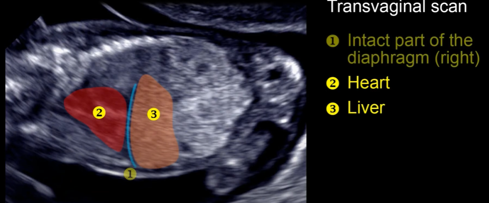 MRI Image Preview