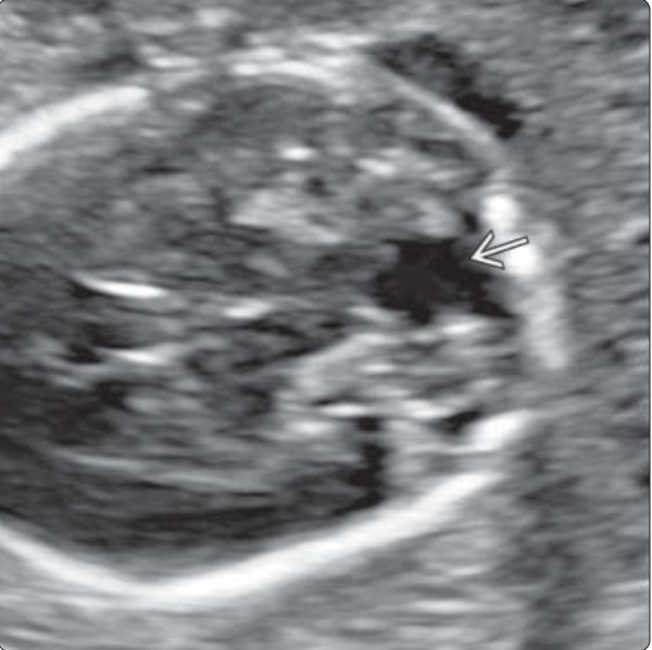 MRI Image Preview
