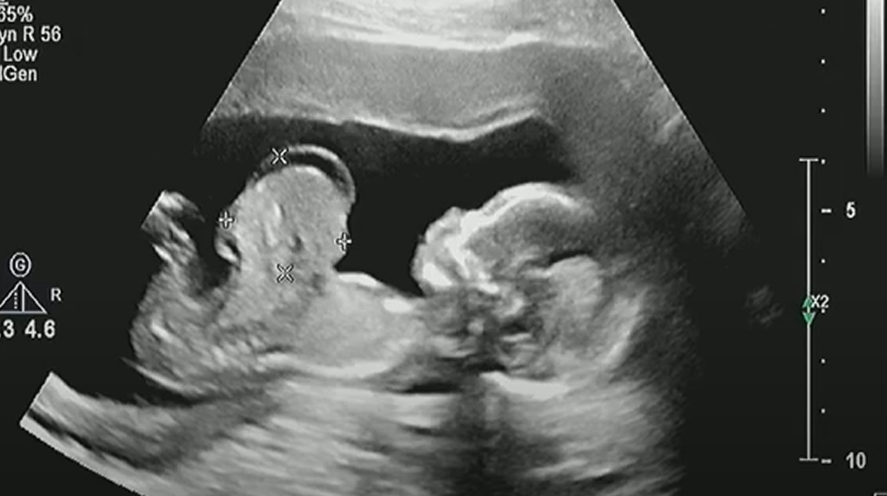 MRI Image Preview