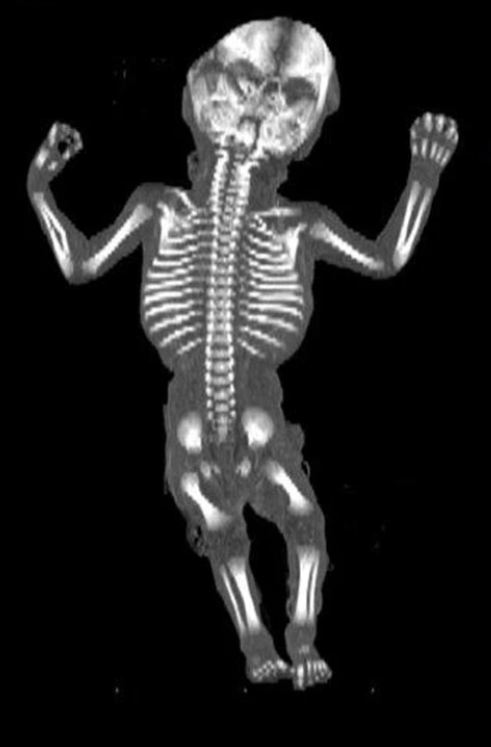 MRI Image Preview