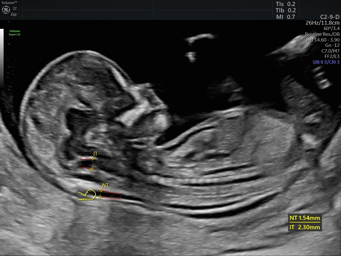MRI Image Preview