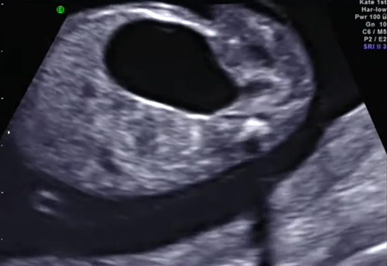 MRI Image Preview