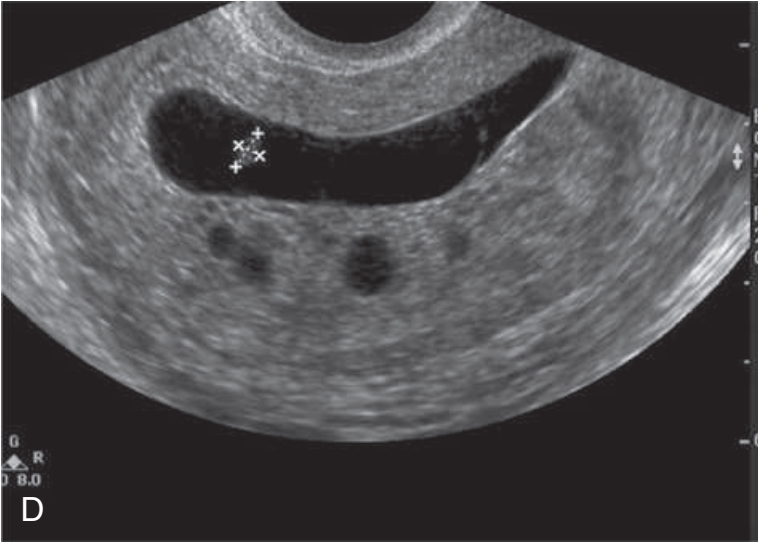 MRI Image Preview