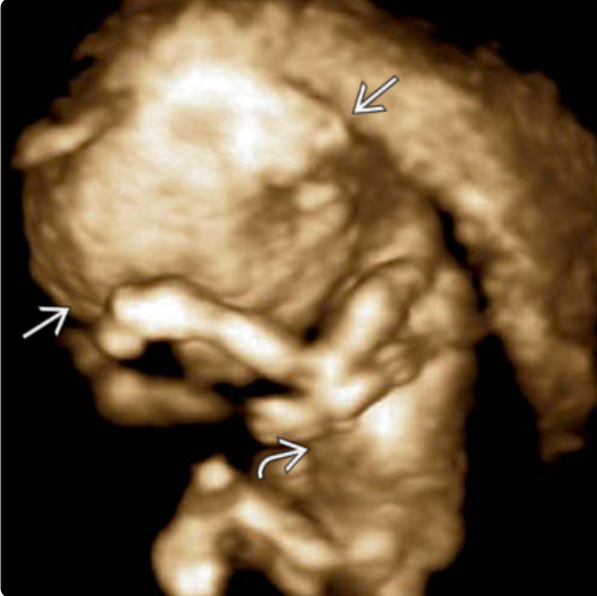 MRI Image Preview