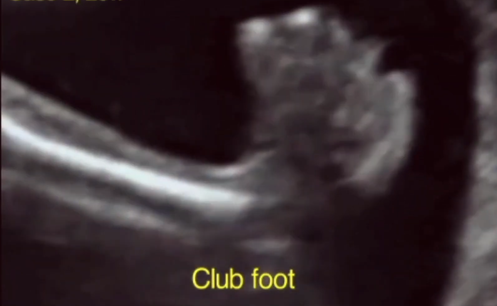 MRI Image Preview
