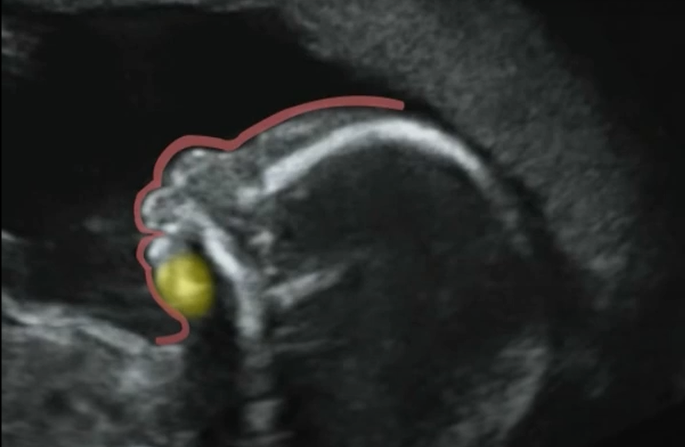 MRI Image Preview