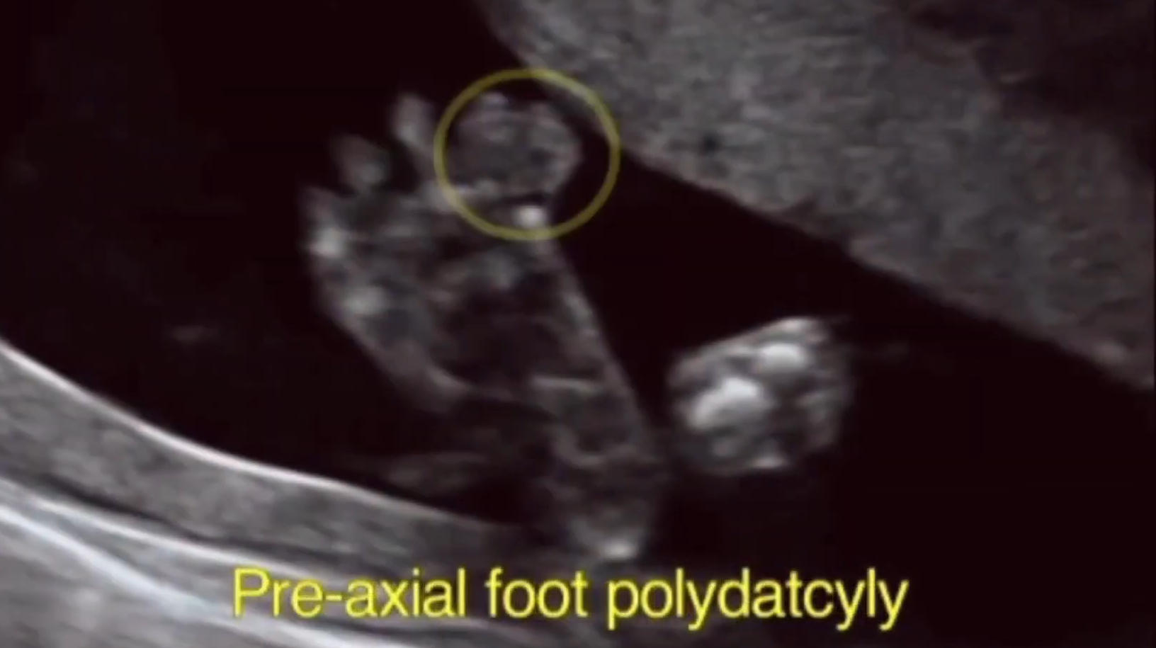 MRI Image Preview
