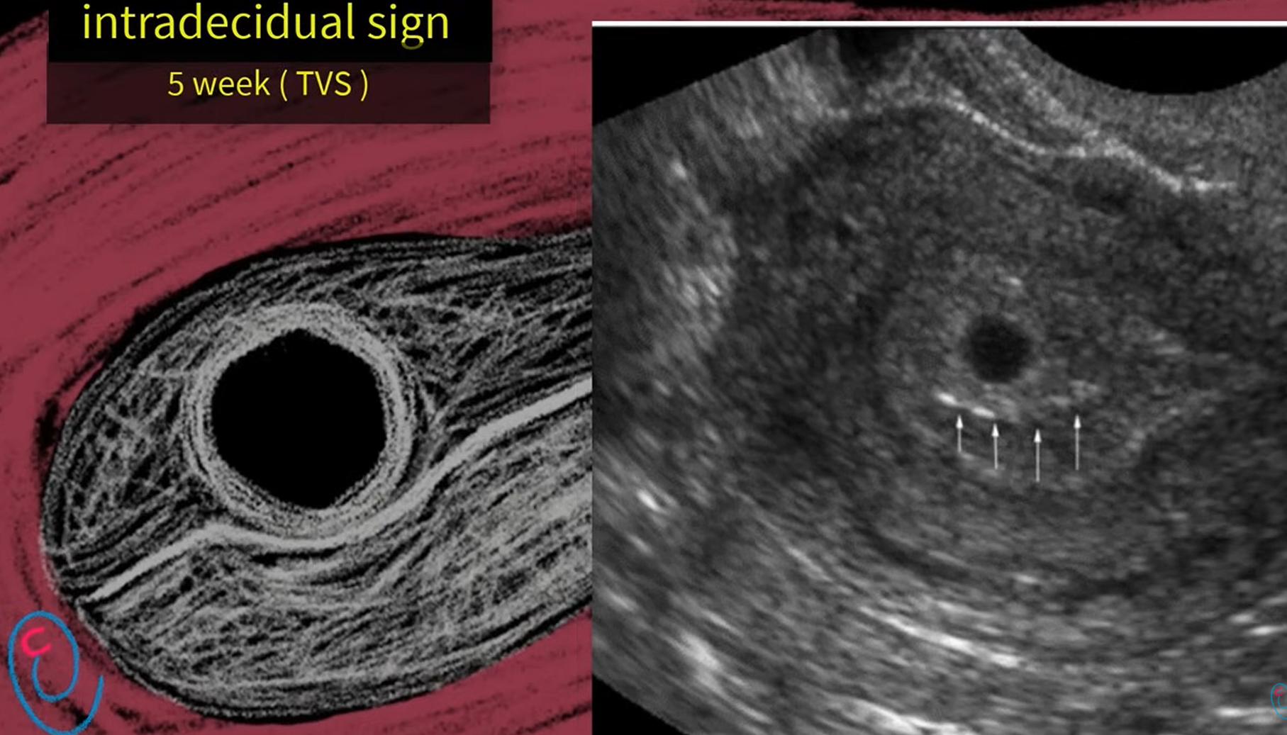 MRI Image Preview