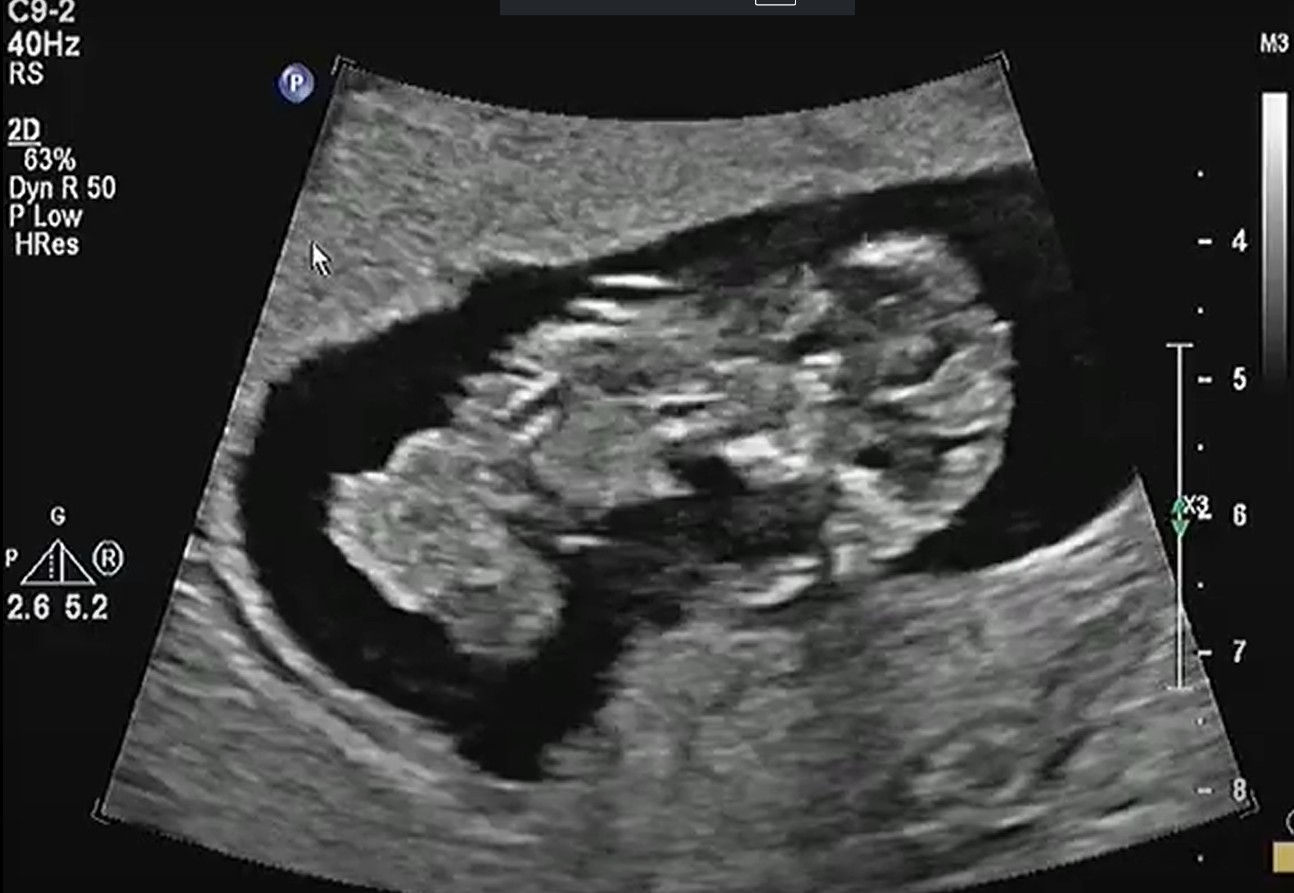 MRI Image Preview