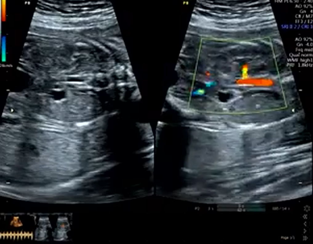 MRI Image Preview