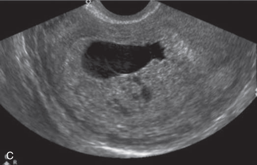 MRI Image Preview