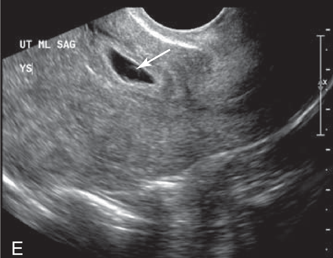 MRI Image Preview