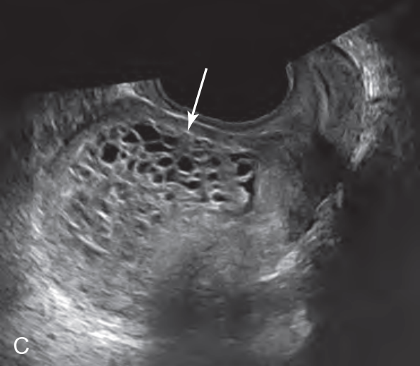 MRI Image Preview