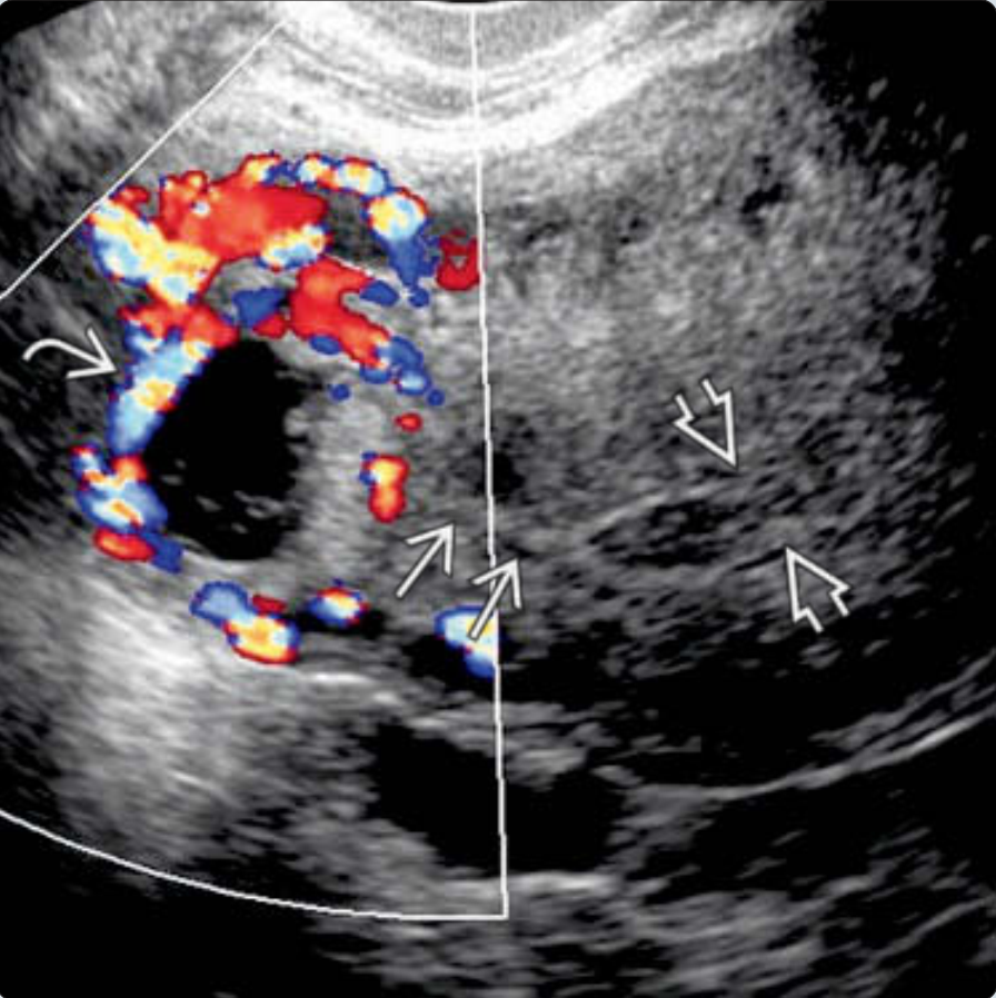 MRI Image Preview