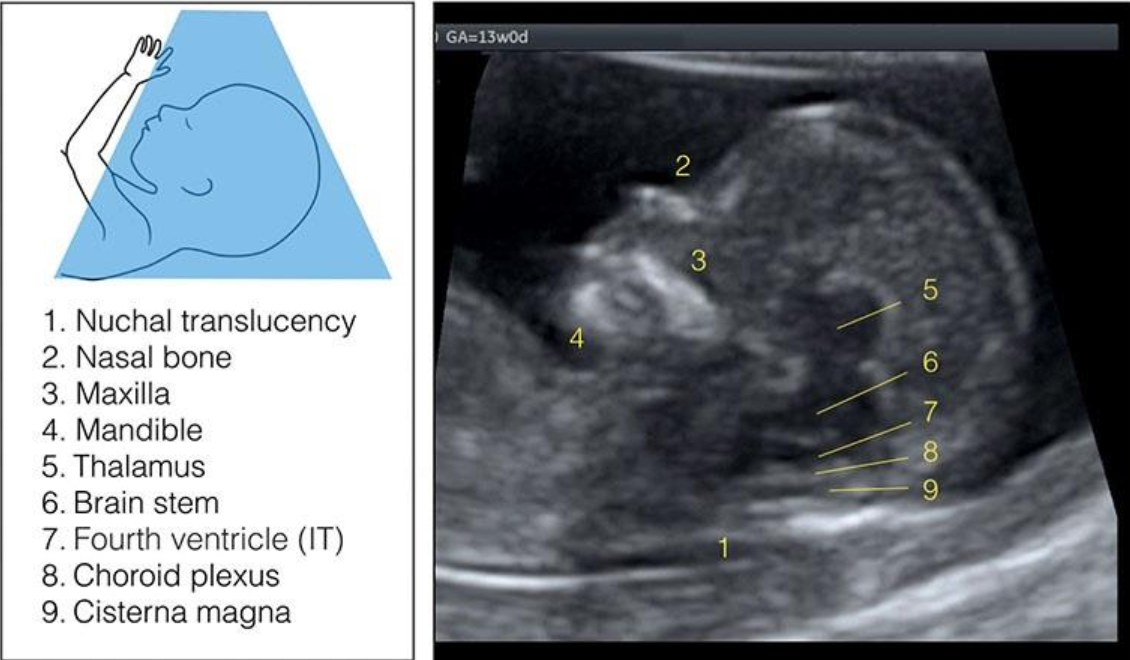MRI Image Preview
