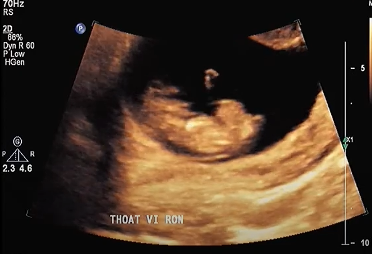MRI Image Preview