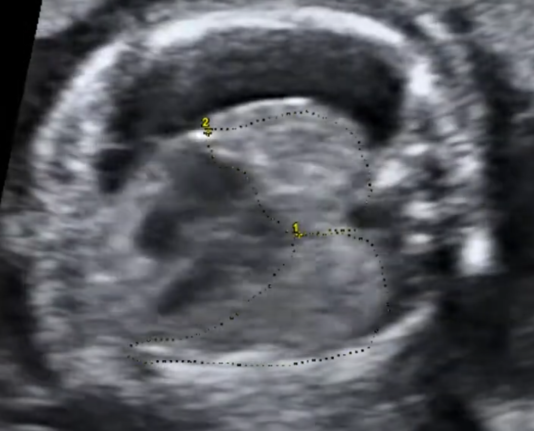 MRI Image Preview