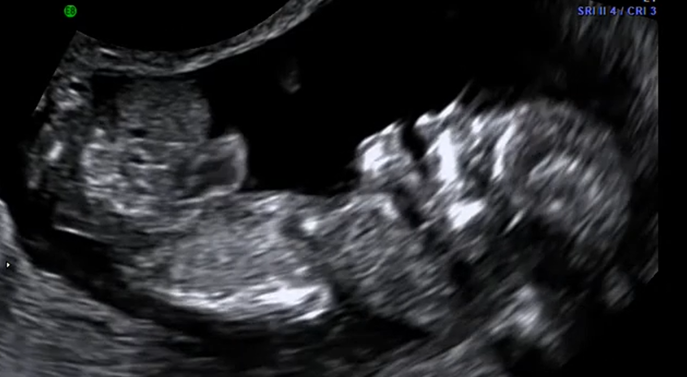 MRI Image Preview