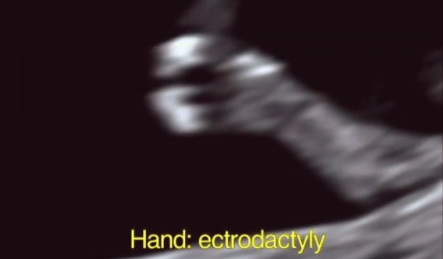 MRI Image Preview