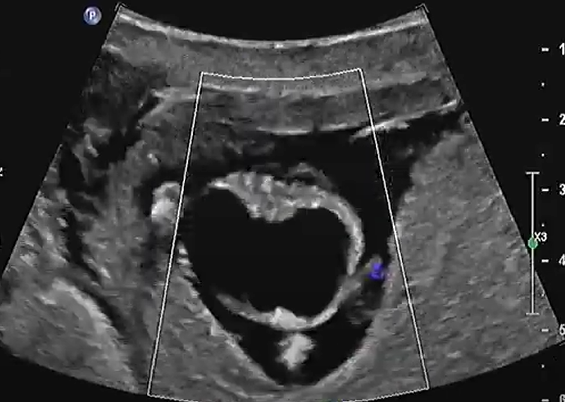 MRI Image Preview