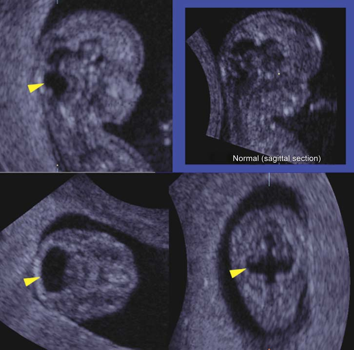 MRI Image Preview