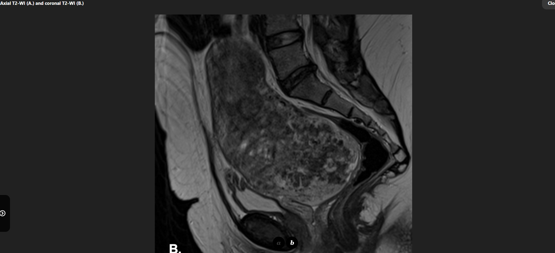 MRI Image Preview
