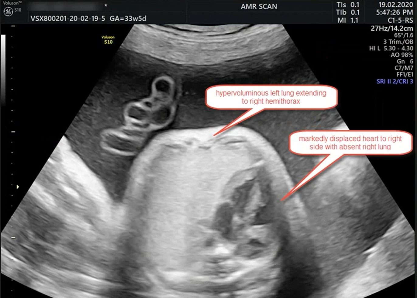 MRI Image Preview