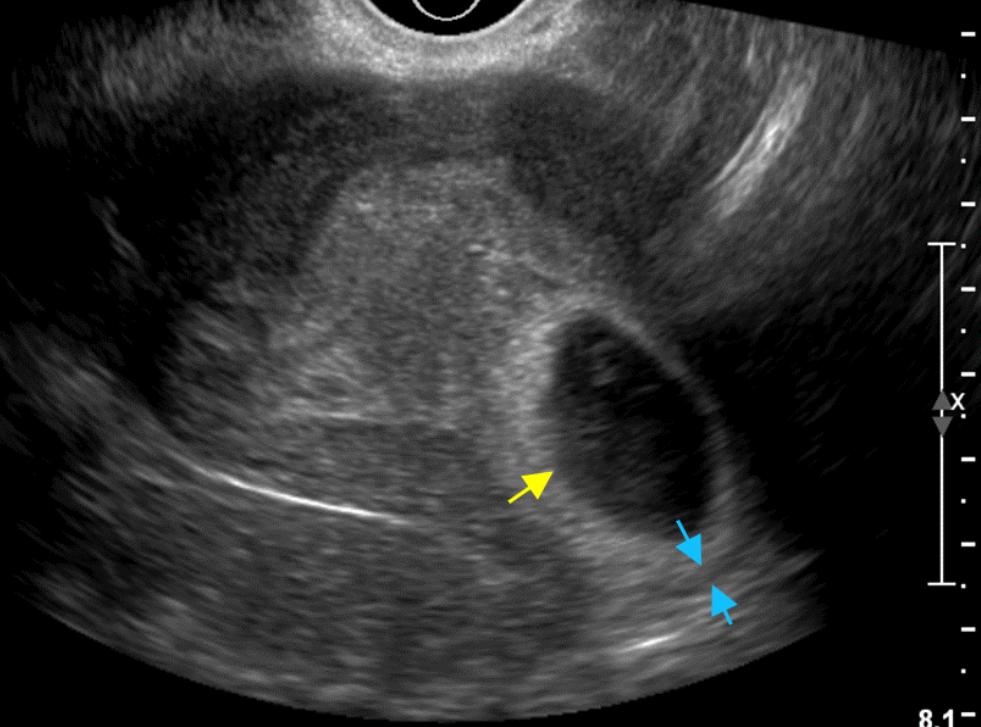 MRI Image Preview