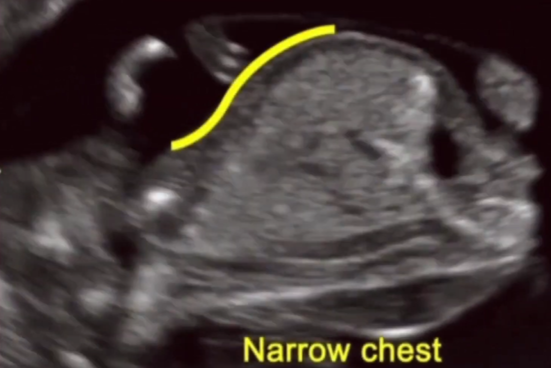MRI Image Preview
