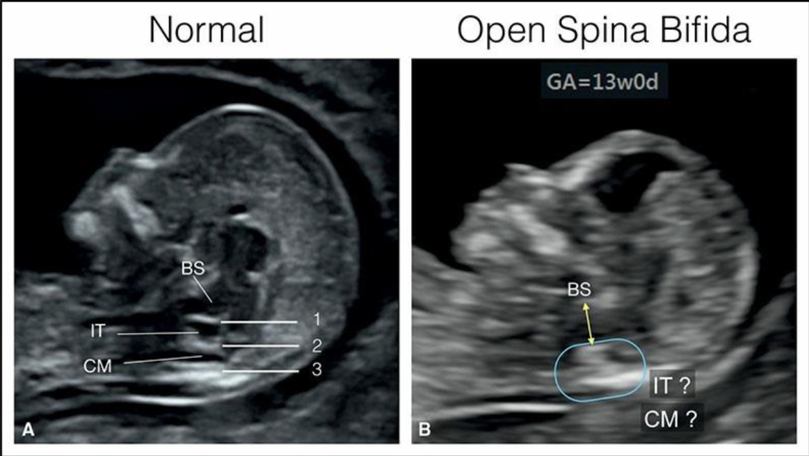 MRI Image Preview