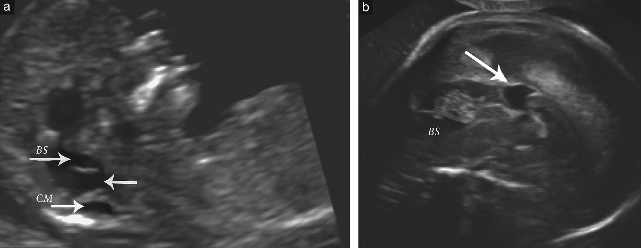 MRI Image Preview