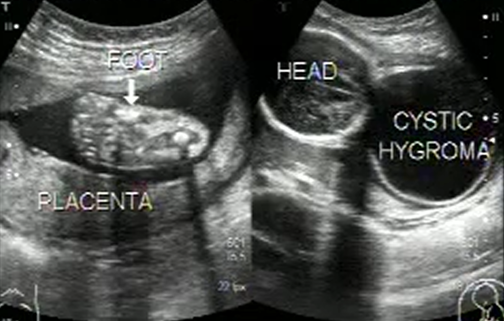 MRI Image Preview