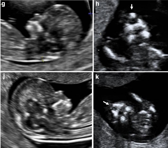 MRI Image Preview