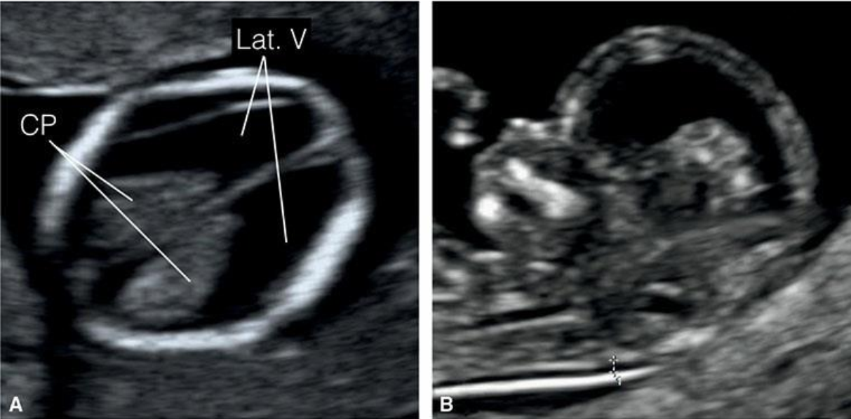 MRI Image Preview