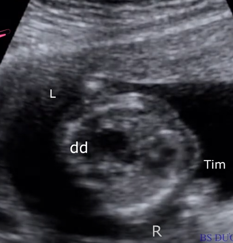 MRI Image Preview
