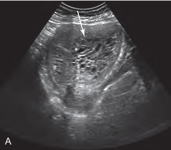 MRI Image Preview