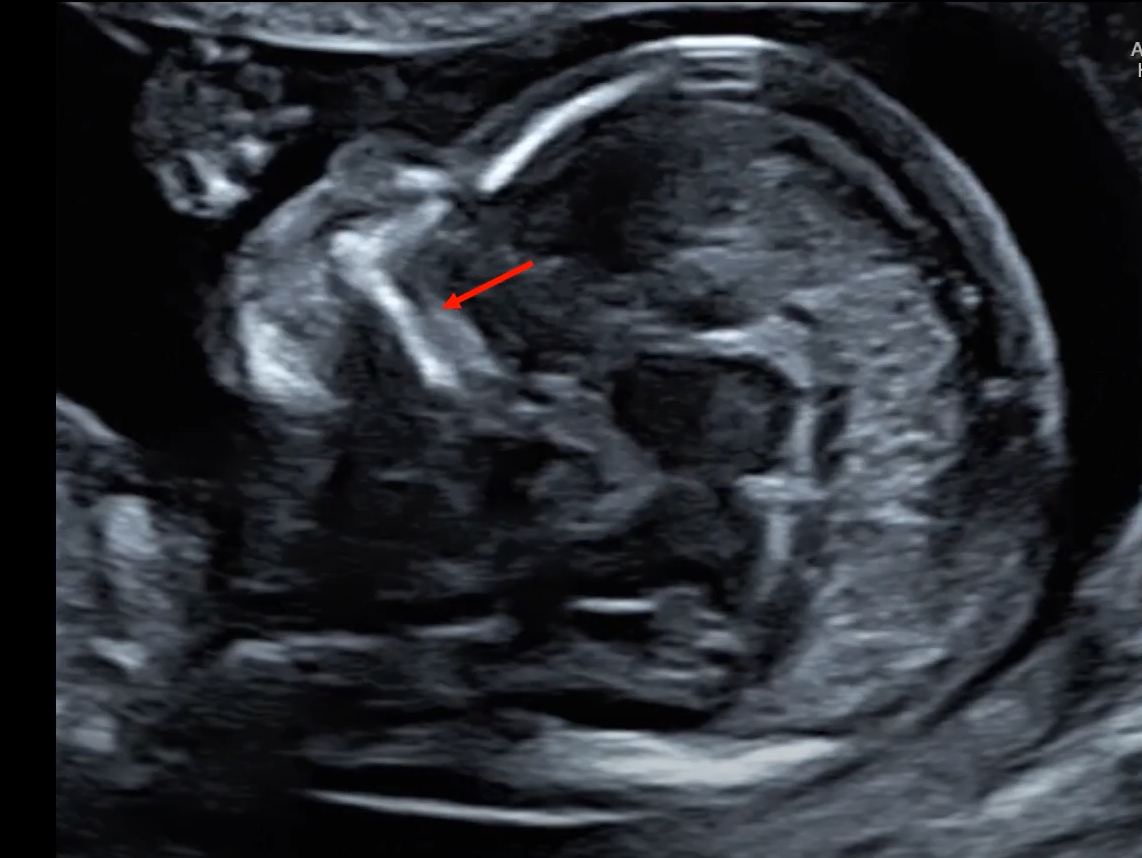 MRI Image Preview