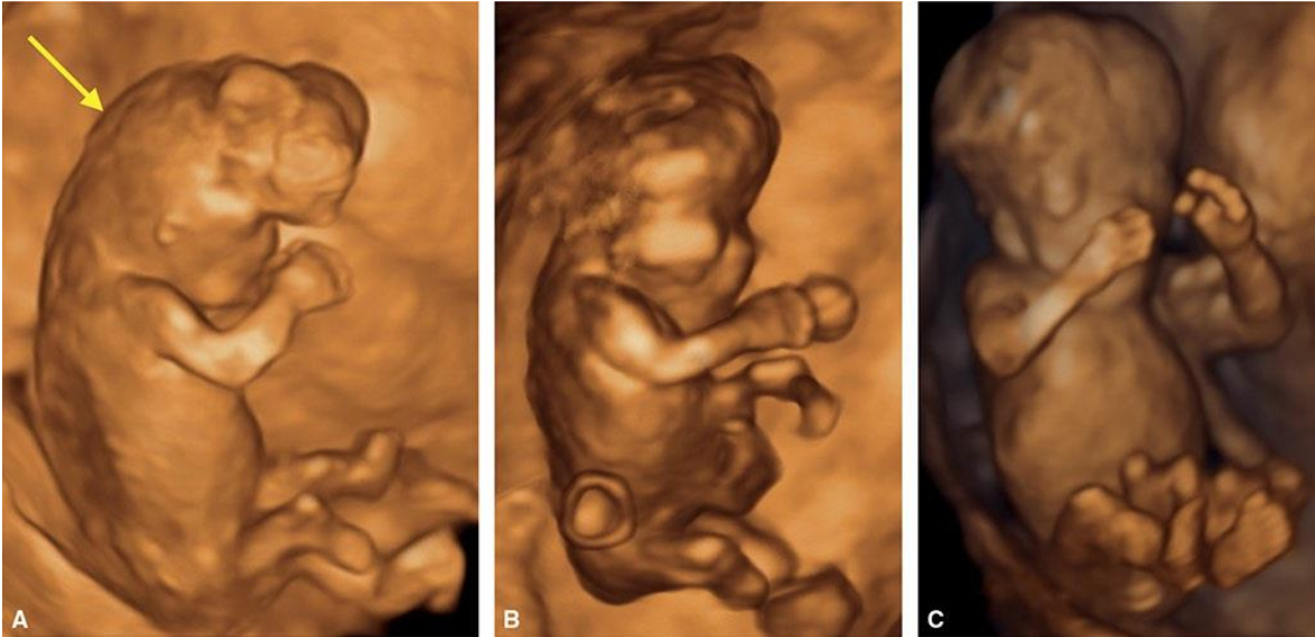 MRI Image Preview