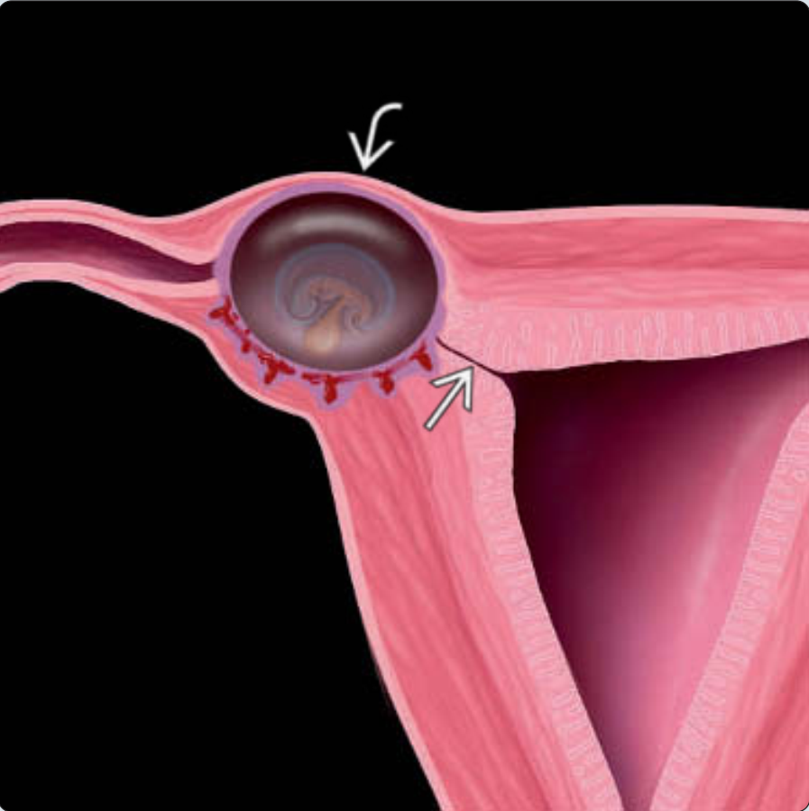 MRI Image Preview