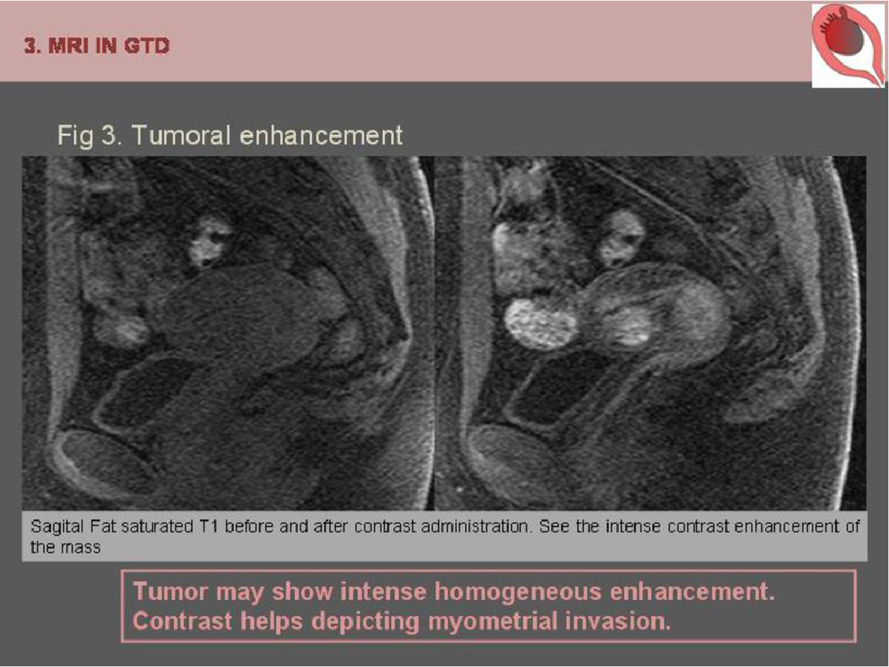 MRI Image Preview
