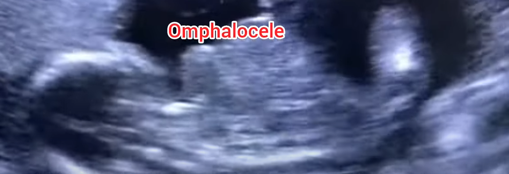 MRI Image Preview